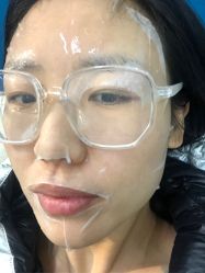 -More摩尔医美の注射线雕光电中心