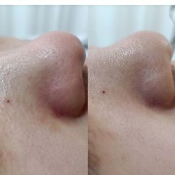 -Cream88颜皮肤管理中心