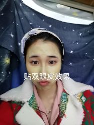 体验前-广州美莱医疗美容医院