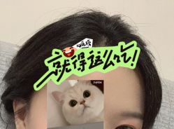 -大麦微针植发全国连锁