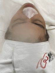 体验前-苗方清颜专业祛痘连锁机构