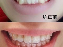 -极光口腔·矫正种植修复(锦江店)
