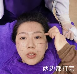 体验后-美莱医学美容医院