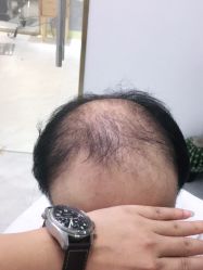 -发饰美男士增发补发假发定制店