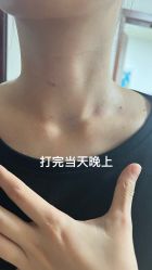 体验后-深圳阳光医疗美容医院·旗舰店