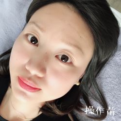 -西施无菌半永久纹绣眉眼影唇轻增发纹发际线