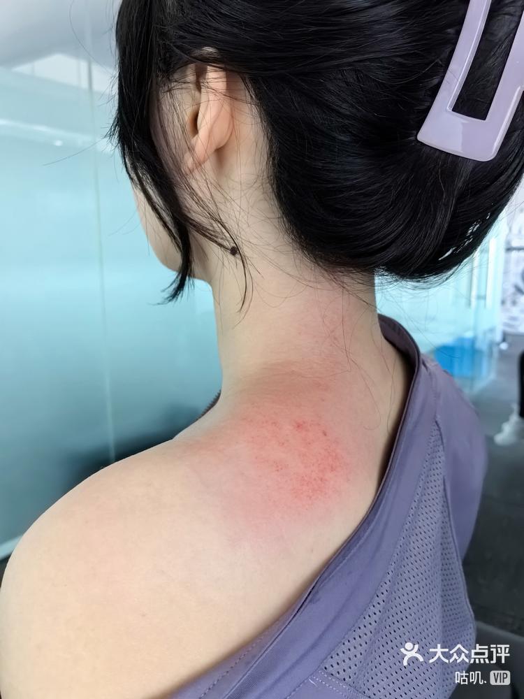 筋膜刀的作用