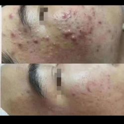 -蕾特恩专业祛痘·皮肤管理