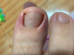 -杨一刀修脚(马连道南街店)