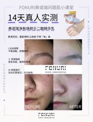 -春田皮肤管理中心品牌旗舰店