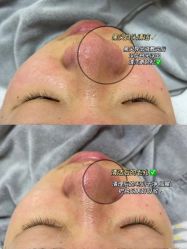 -LUNA皮相美·骨相美高级美感