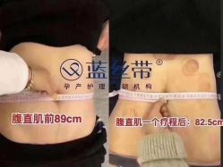 -蓝丝带催乳产康产后恢复中心(殷巷店)