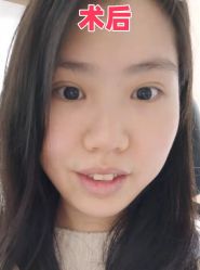 -素美医疗美容·西南眼鼻整形·修复基地
