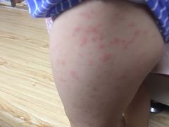 -龙达温泉生态城