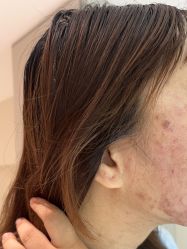 -柯莲娜医学美容