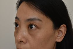 -天津健丽·去眼袋医疗美容机构