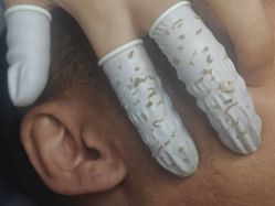 -瑶芳清颜草本祛痘