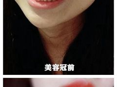 -团圆口腔·种植中心(锦江院区)