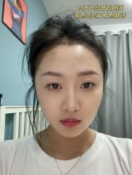 点击看大图 -雍禾植发全国连锁