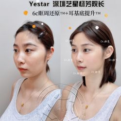 -深圳艺星医疗美容医院