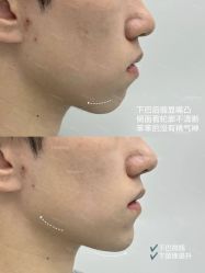 点击看大图 -深圳艺星医疗美容医院