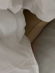 -广州紫馨整形外科医院