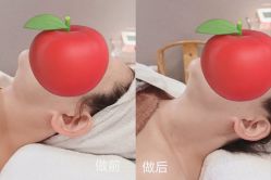 -美玫美容SPA护理中心