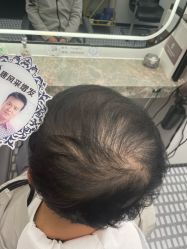 -唐风采假发补发定制
