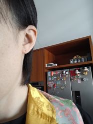 -应超小李飞刀整形