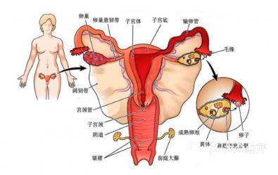 卵巢位于女性盆腔的深部,而且非常小,正常情况下,卵巢在体表是温圹