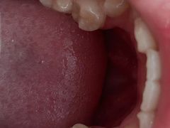 -宁波壹加壹口腔·矫正种植中心