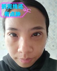 -素美医疗美容·西南眼鼻整形·修复基地