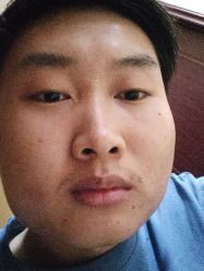 体验后-安徽合肥韩美整形外科医院