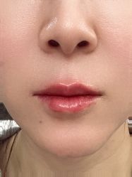 体验后-上海首尔丽格医疗美容医院
