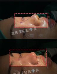-北京米扬丽格医疗美容·联合丽格鼻整形中心