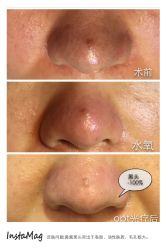 脸部抗衰-光SPA科技美肤