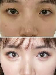 -SKINIST丽铂医疗美容