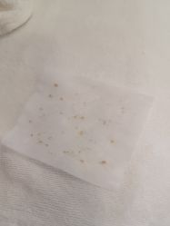 -塑青春&伊肤泉祛痘皮肤管理