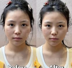 -颜和骨正&明星徒手小颜整骨