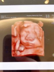 -杭州贝瑞斯美华妇儿医院·早孕·产检·儿科