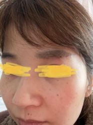 -大华韩艺整形美容医院