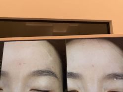 -苑苑vbeauty科技美容SPA