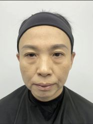 -天津健丽·去眼袋医疗美容机构