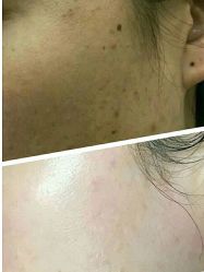 -苗方清颜痘肌研究所