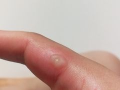 -无锡市第二人民医院(南院)