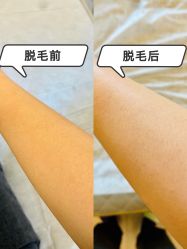 -椿禾家专业日式脱毛