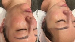 -安吉拉青春化管理中心