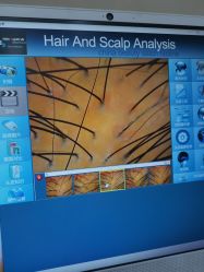 -熙朵美学植发·连锁品牌