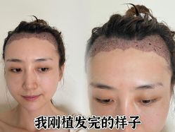 -雍禾植发全国连锁