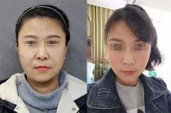 -加减美医美连锁品牌